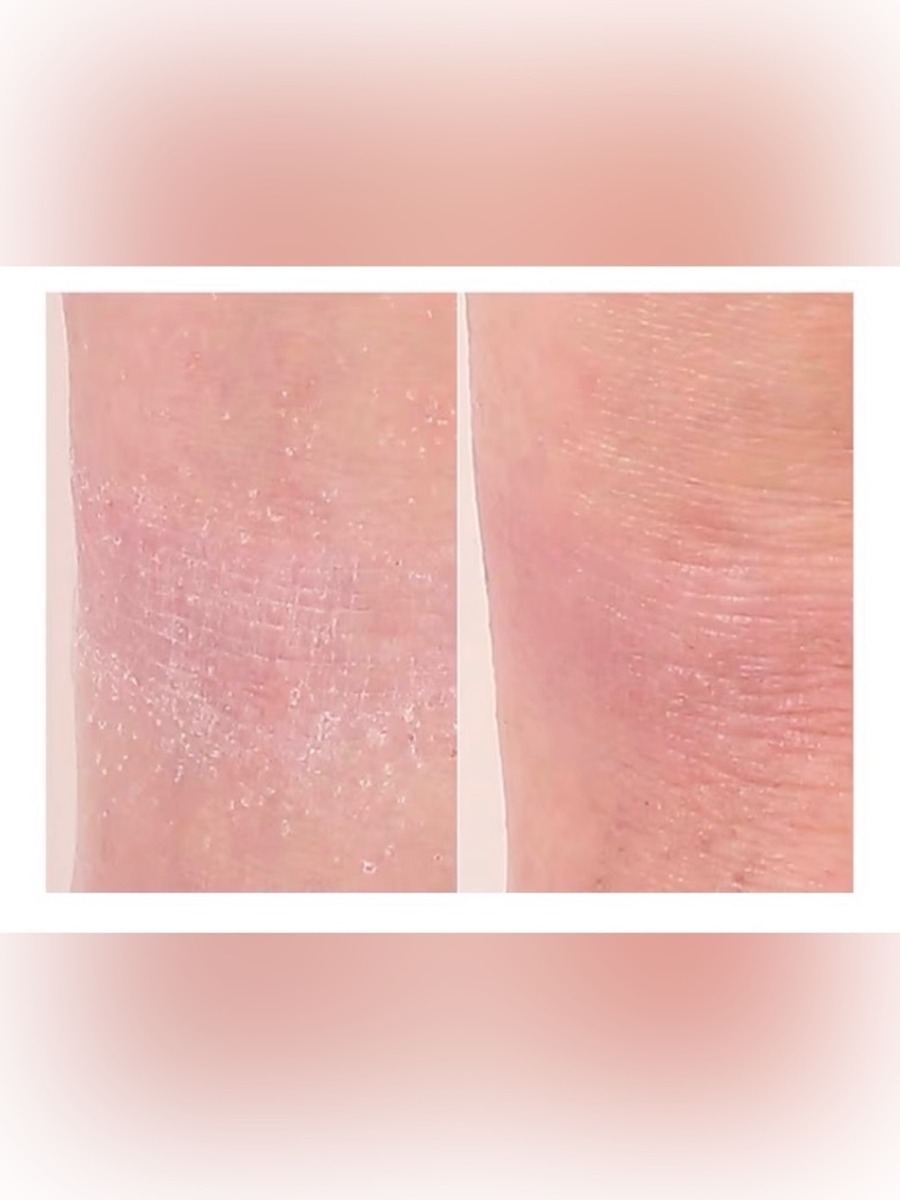 Nakery Beauty Soothing Face and body wash for Eczema, dryness, & redness New - Picture 6 of 7